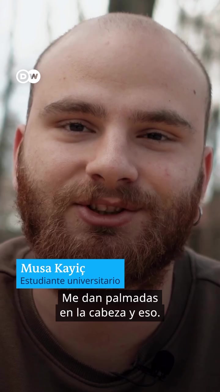 Musa y la lucha contra las burlas por alopecia